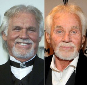 Dr. Andrew Miller discusses what went wrong with Country crooner Kenny Rogers’ browlift.
