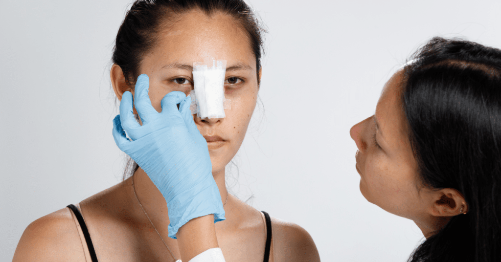 VIDEO: What Is Recovery Like After Rhinoplasty?