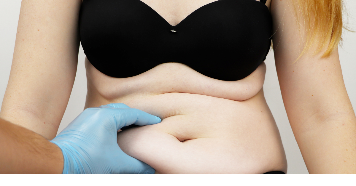 Does Liposuction Hurt?